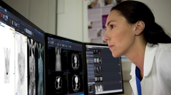 Falhas críticas relatadas nos sistemas de imagens médicas Philips Vue PACS